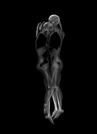 Illustration for article titled Tender and Playful X-Ray Portraits of Couples